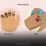 The Plague