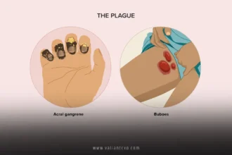 The Plague